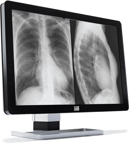 Image: The Barco Coronis Fusion 10 MP grayscale monitor (photo courtesy Barco).